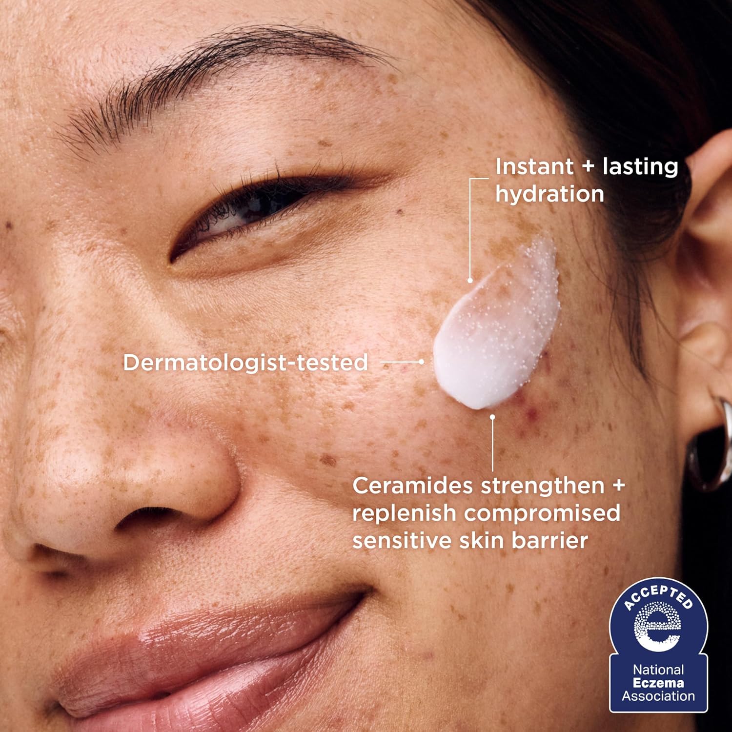 Aestura | Atobarrier 365 Cream