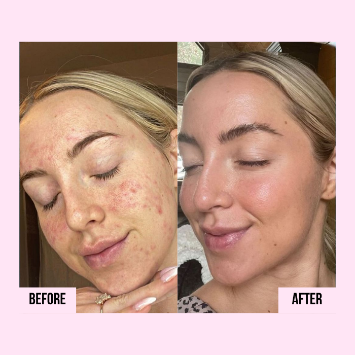 Medicube | PDRN Pink Collagen Capsule Cream