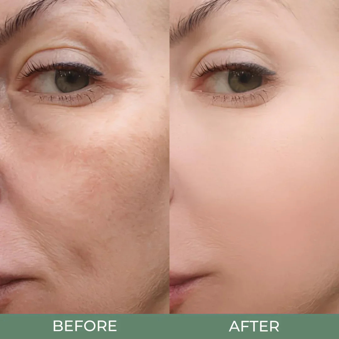 Dr. Melaxin Peel Shot Glow Rice Ampoule Duo