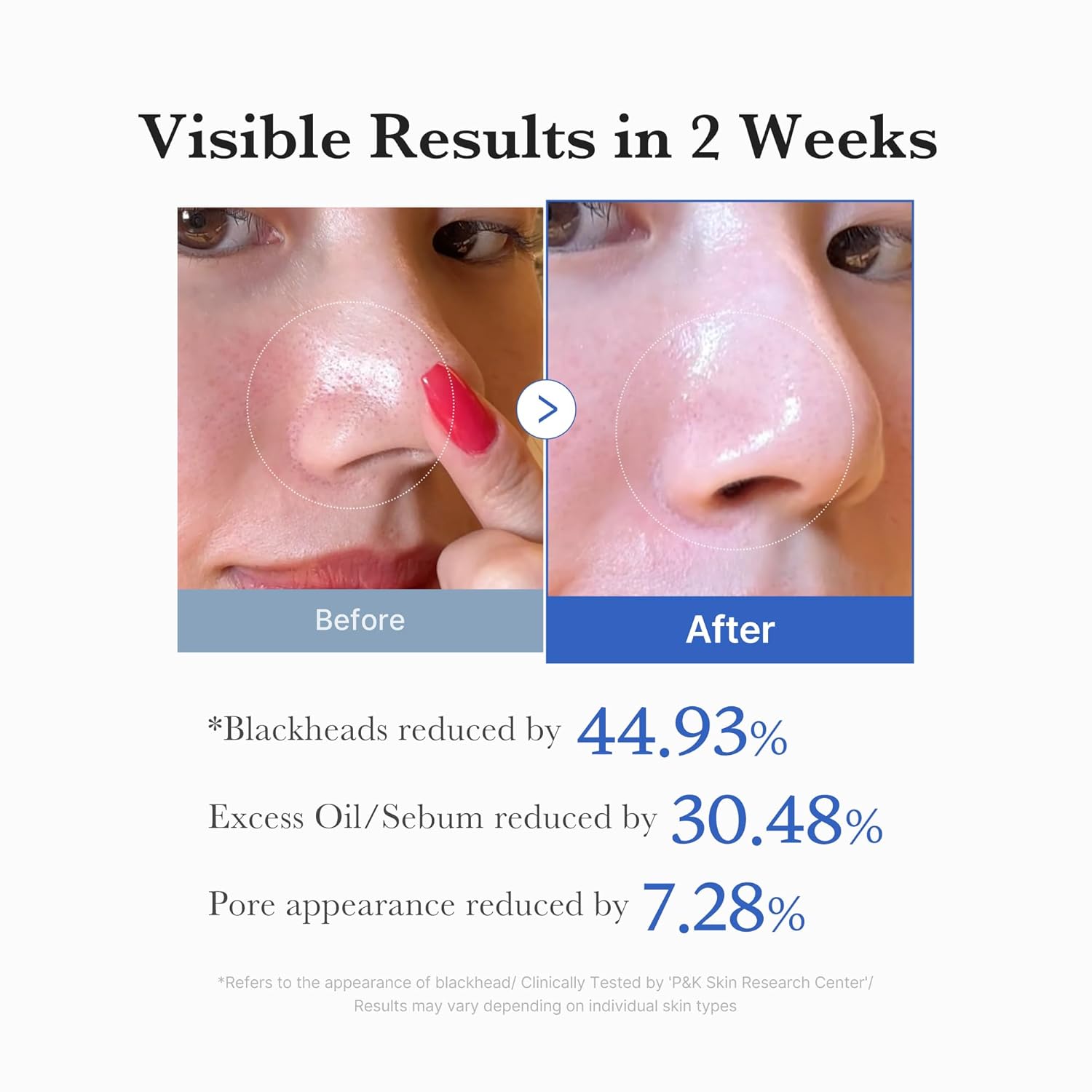 Medicube | Zero Pore Pad 2.0