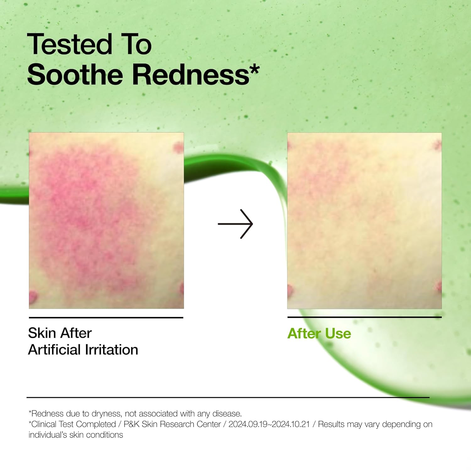 Anua | Azelaic Acid Serum