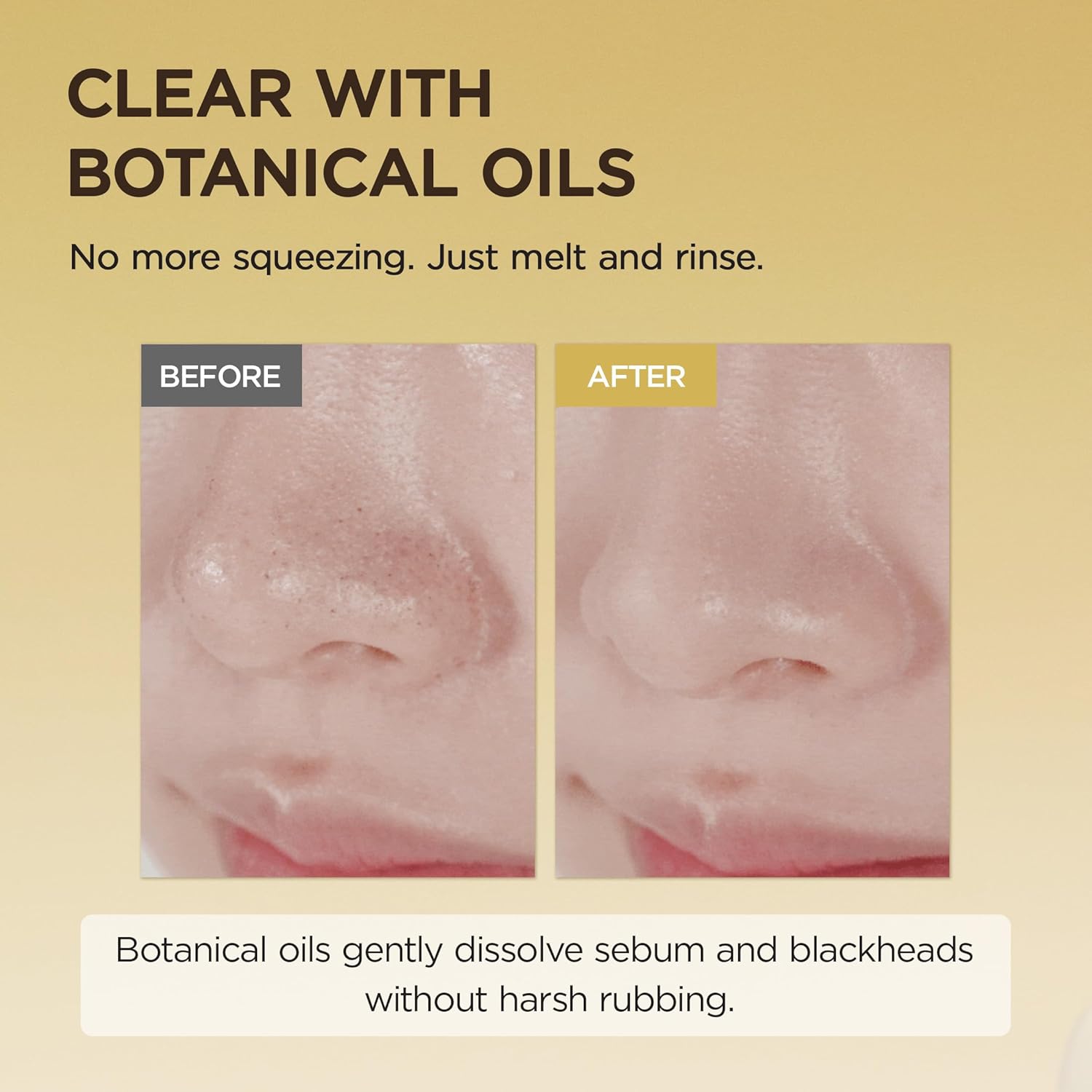 SKIN1004 | Madagascar Centella Light Cleansing Oil