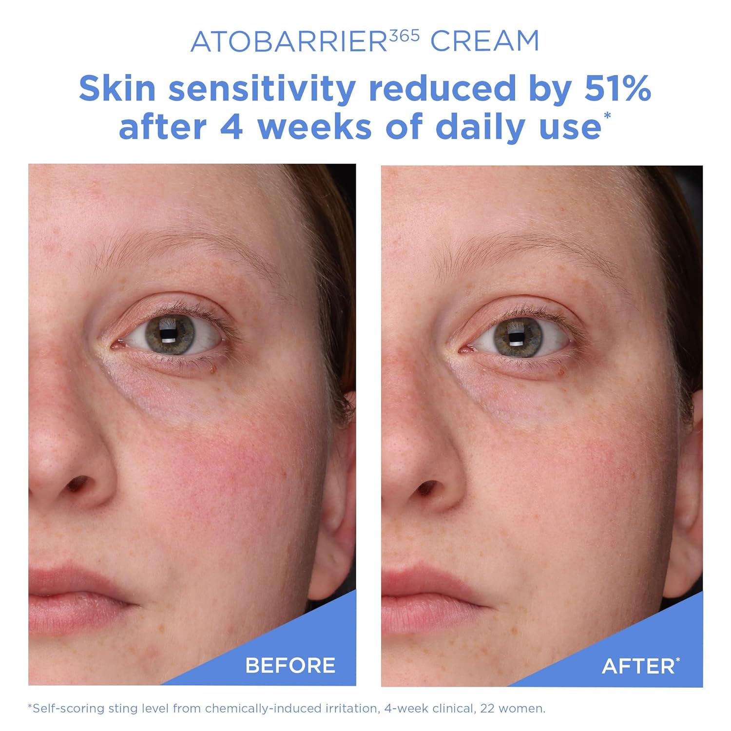 Aestura | Atobarrier 365 Cream