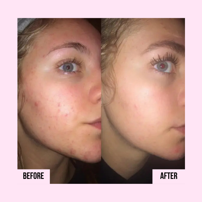Medicube | PDRN Pink Collagen Capsule Cream