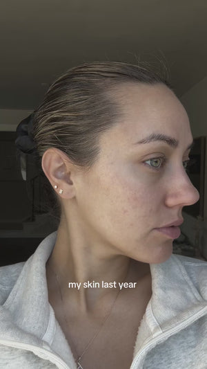 Sarah, 31