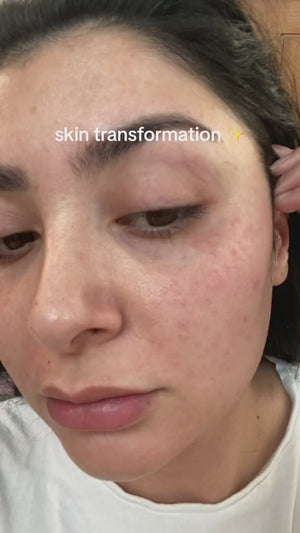Freya, 29
