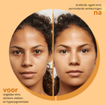 Tumeric & Kojic Acid Soap - skin28