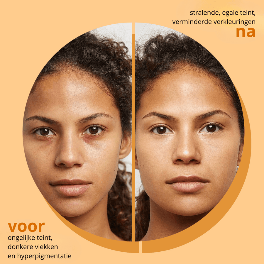 Tumeric & Kojic Acid Soap - skin28